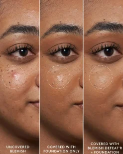 Blemish Defeat'r BHA Spot-Targeting Gel