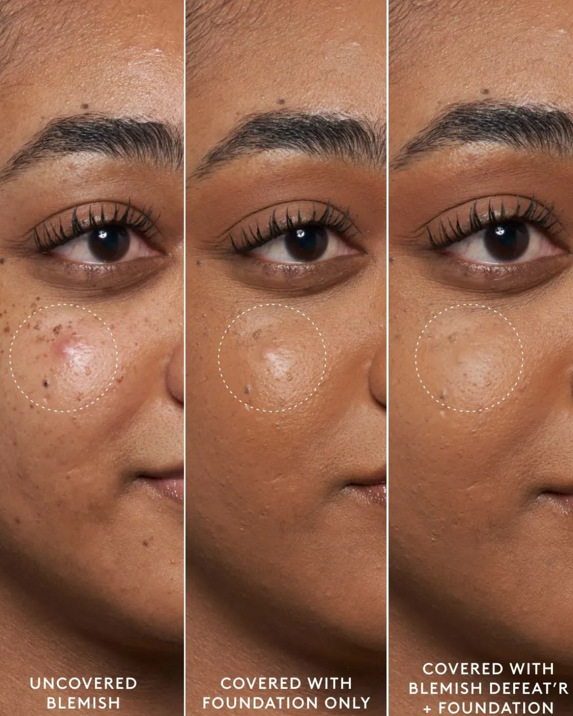 Blemish Defeat'r BHA Spot-Targeting Gel
