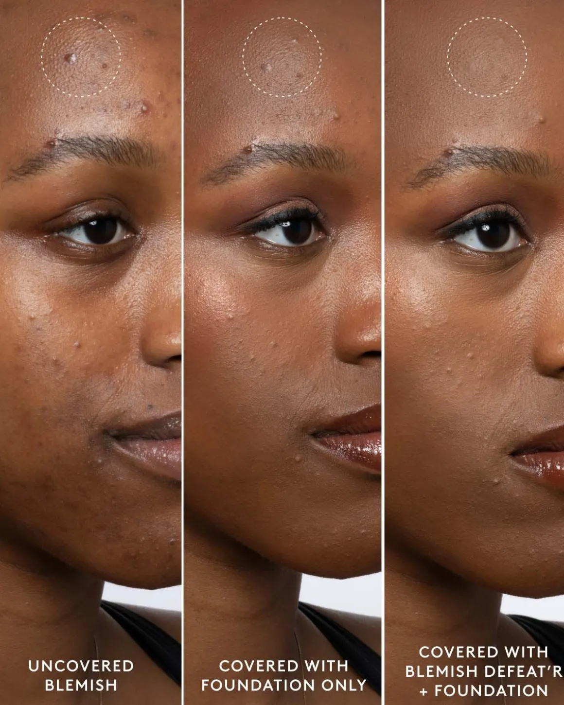 Blemish Defeat'r BHA Spot-Targeting Gel