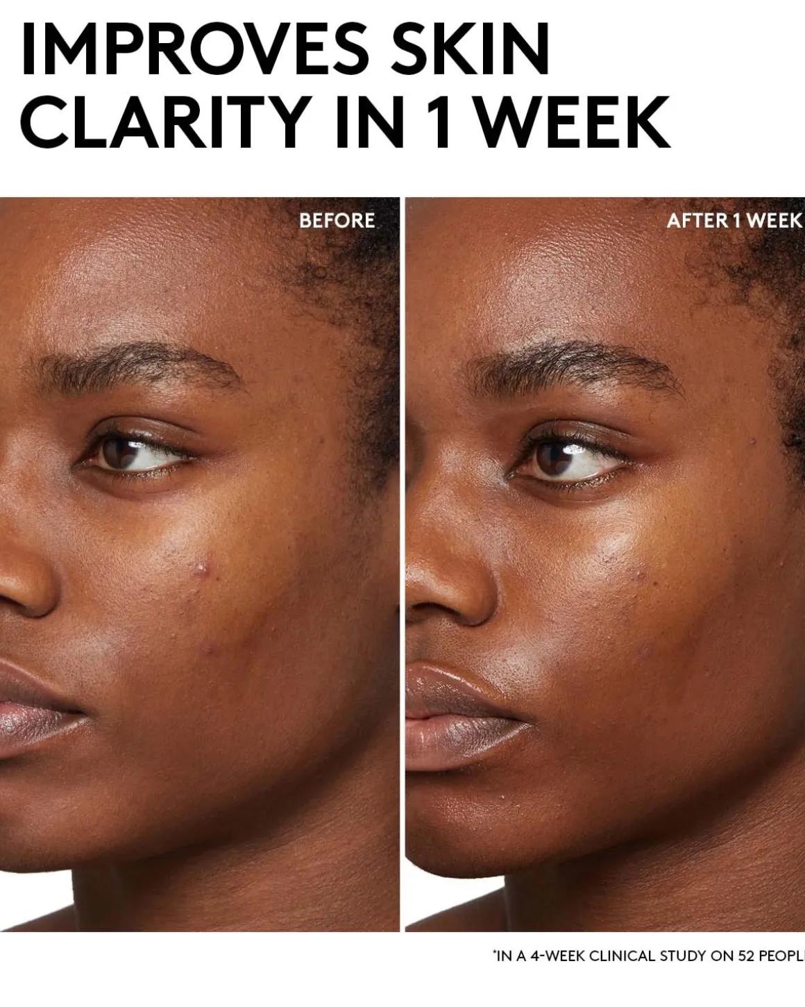 Cherry Dub BHA Toner with Salicylic Acid + Aloe Juice